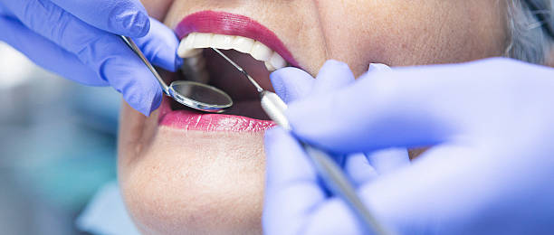 Best Emergency Gum Treatment in Gothenburg, NE